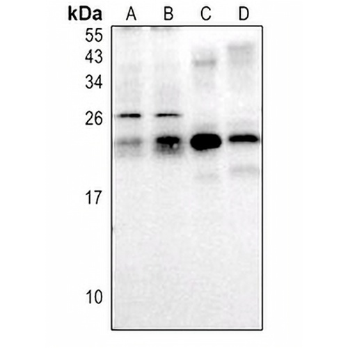 RAB30 Rabbit Polyclonal Antibody