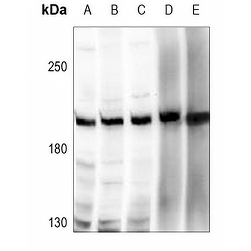 ZNF638 Rabbit Polyclonal Antibody