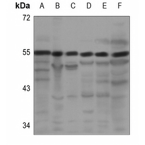 PRPF19 Rabbit Polyclonal Antibody