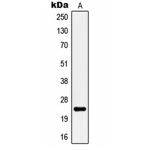 KCNMB4 Rabbit Polyclonal Antibody
