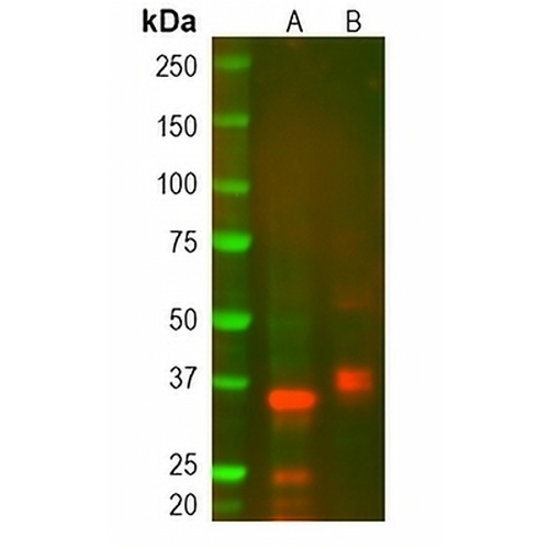 TRBC1 Rabbit Polyclonal Antibody