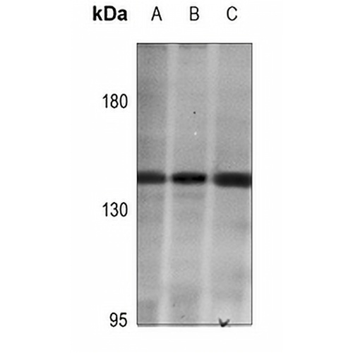HIPK2 Rabbit Polyclonal Antibody