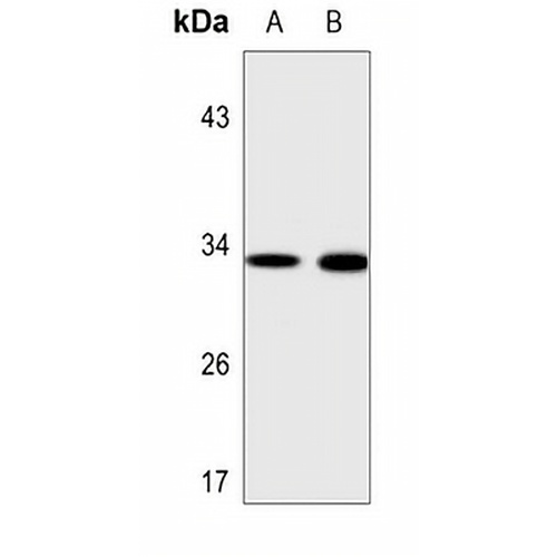 MRPL15 Rabbit Polyclonal Antibody