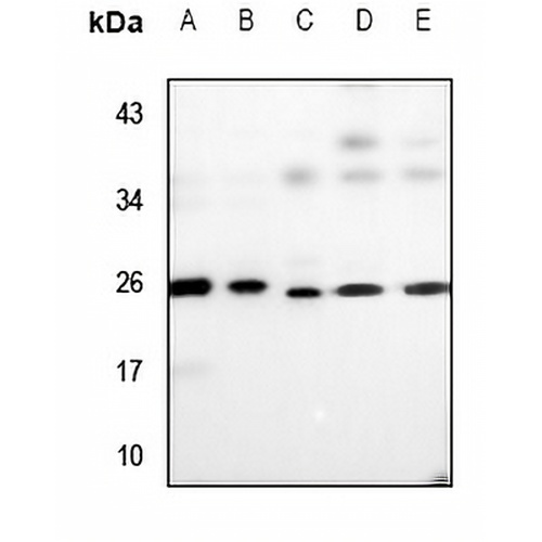 UBE2T Rabbit Polyclonal Antibody