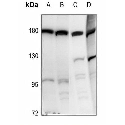 DROSHA Rabbit Polyclonal Antibody