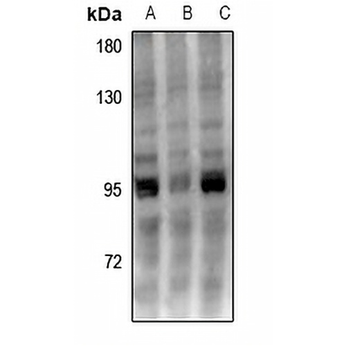 UHRF1 Rabbit Polyclonal Antibody