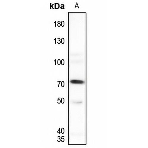 SENP1 Rabbit Polyclonal Antibody