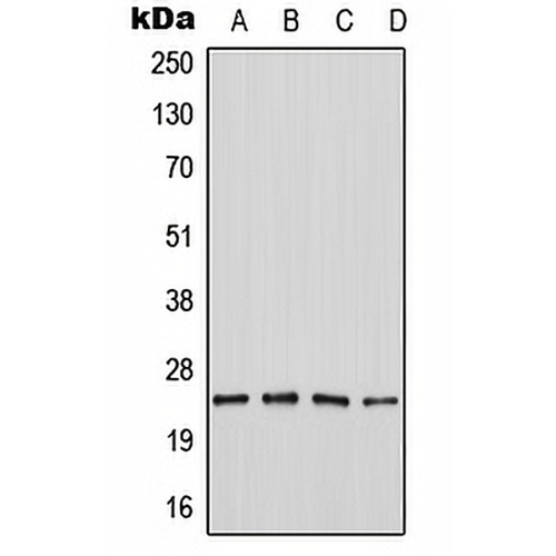 SEI-1 Rabbit Polyclonal Antibody