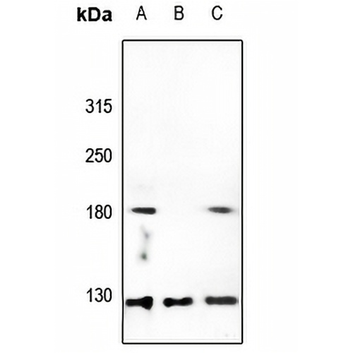 Collagen 5 alpha 3 Rabbit Polyclonal Antibody