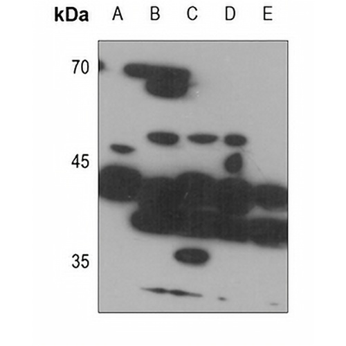 ZDHHC9 Rabbit Polyclonal Antibody