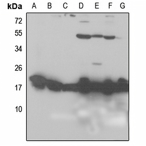 RPL26L1 Rabbit Polyclonal Antibody