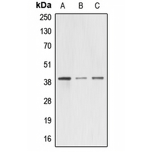 A4GNT Rabbit Polyclonal Antibody