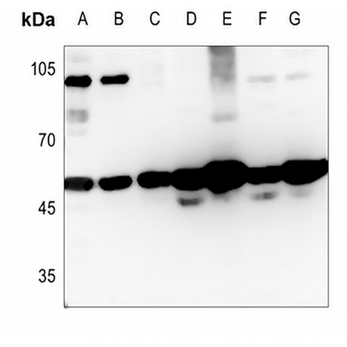 MAGEC2 Rabbit Polyclonal Antibody