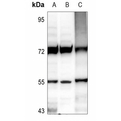 IP6K2 Rabbit Polyclonal Antibody