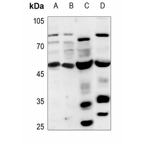 PPHLN1 Rabbit Polyclonal Antibody