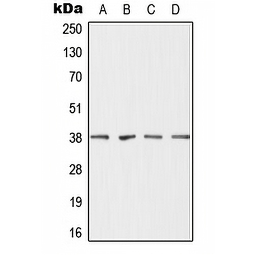 DHRS7 Rabbit Polyclonal Antibody