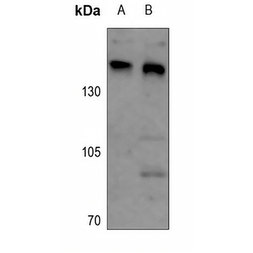 ARID4B Rabbit Polyclonal Antibody