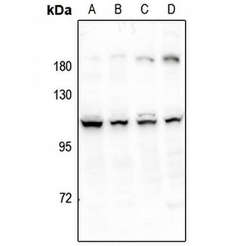 ERAP1 Rabbit Polyclonal Antibody
