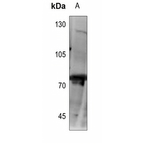 CLIP4 Rabbit Polyclonal Antibody