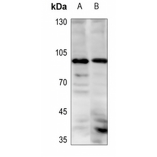 ETAA1 Rabbit Polyclonal Antibody