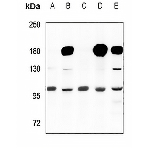 Cyclin M2 Rabbit Polyclonal Antibody
