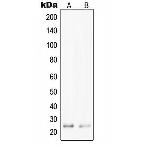 PPP1R14D Rabbit Polyclonal Antibody