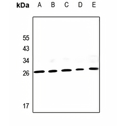 PIGX Rabbit Polyclonal Antibody