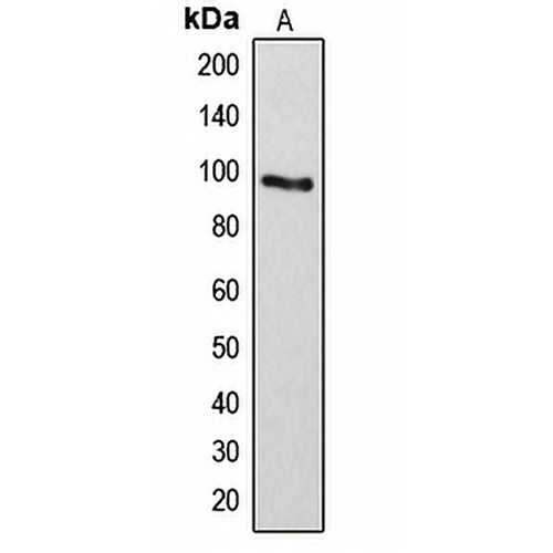 ARHGAP17 Rabbit Polyclonal Antibody
