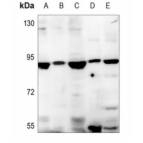 SBAT1 Rabbit Polyclonal Antibody