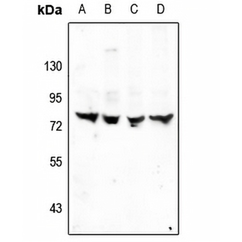 TRIM68 Rabbit Polyclonal Antibody