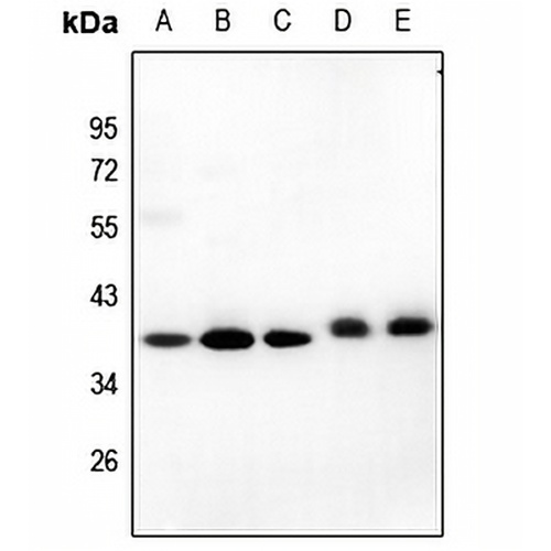 GIMAP4 Rabbit Polyclonal Antibody