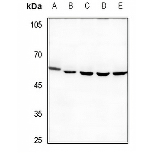 PPP4R1L Rabbit Polyclonal Antibody