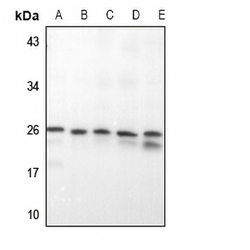 RAB20 Rabbit Polyclonal Antibody