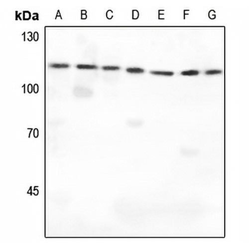 IARS2 Rabbit Polyclonal Antibody