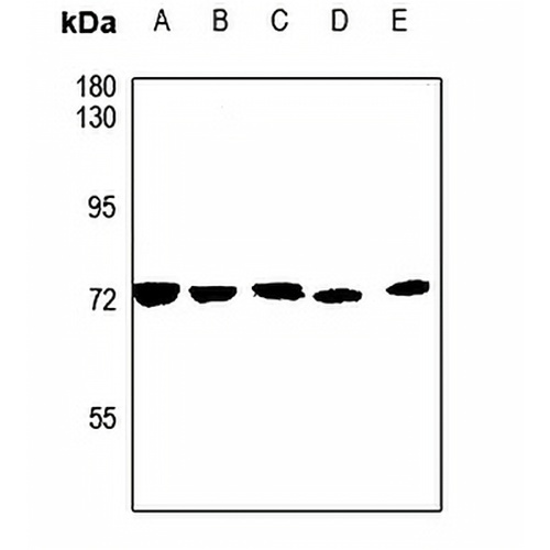 CSGALNACT1 Rabbit Polyclonal Antibody
