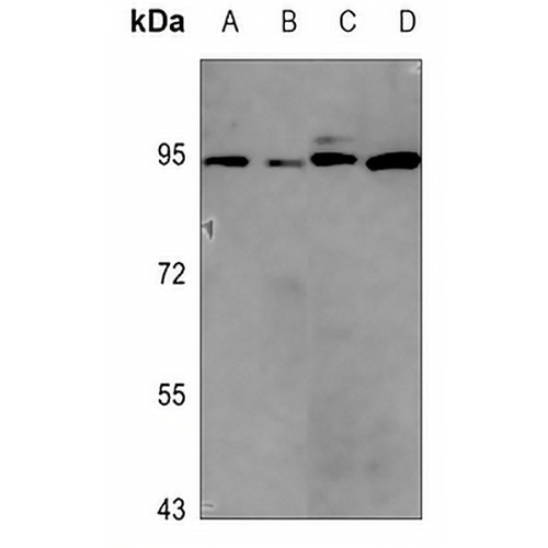 Apolipoprotein E Receptor 2 Rabbit Polyclonal Antibody