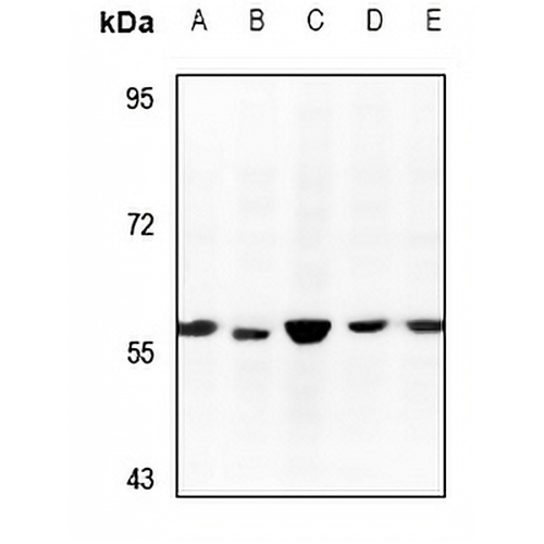 RCC2 Rabbit Polyclonal Antibody