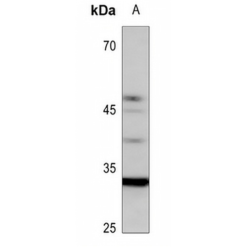 UBFD1 Rabbit Polyclonal Antibody