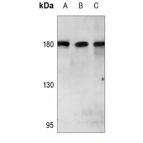 PARD3 Rabbit Polyclonal Antibody