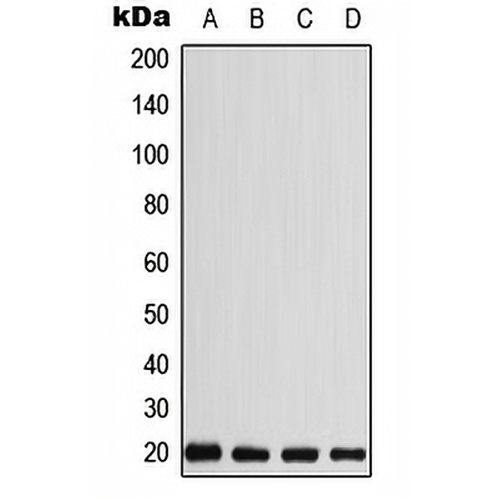 CABP5 Rabbit Polyclonal Antibody