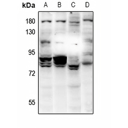 RAD18 Rabbit Polyclonal Antibody