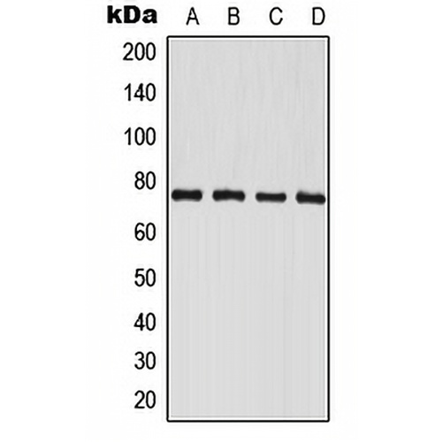 PAK6 Rabbit Polyclonal Antibody