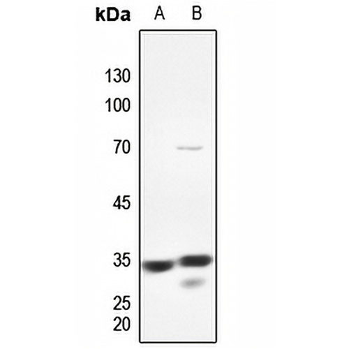PMEPA1 Rabbit Polyclonal Antibody