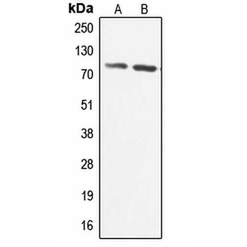 CABC1 Rabbit Polyclonal Antibody