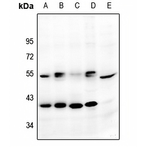 GPR159 Rabbit Polyclonal Antibody