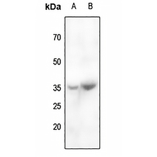 CABP4 Rabbit Polyclonal Antibody
