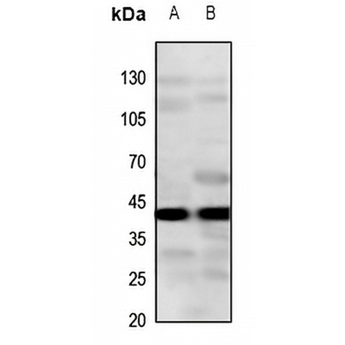 CYSLTR2 Rabbit Polyclonal Antibody