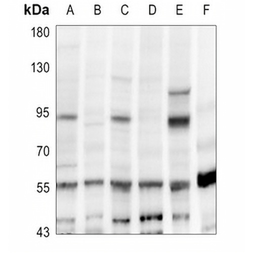 CD248 Rabbit Polyclonal Antibody