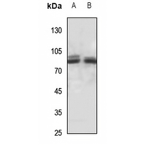 PAK7 Rabbit Polyclonal Antibody