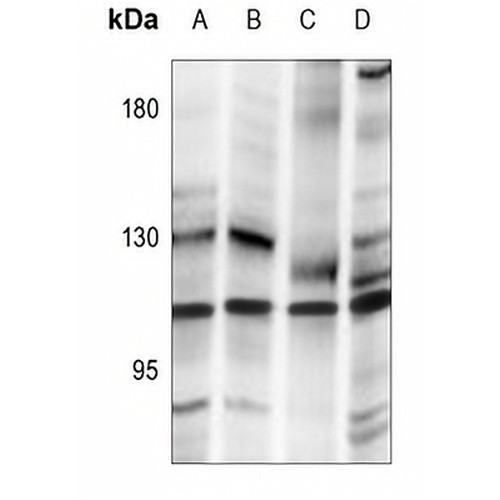 SENP7 Rabbit Polyclonal Antibody